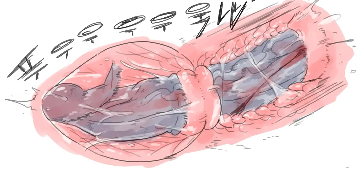 넷캔